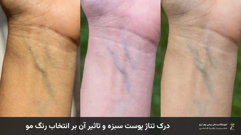 درک تناژ پوست سبزه و تاثیر آن بر انتخاب رنگ مو