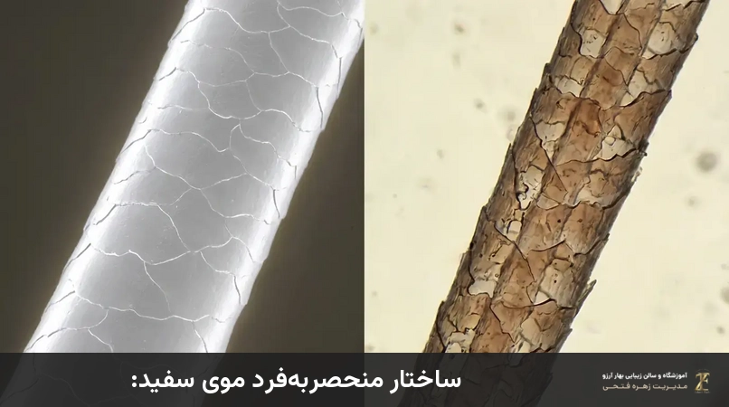 ساختار منحصربهفرد موی سفید:
